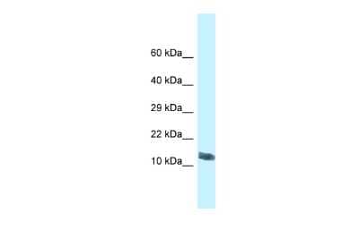 Western Blot: MORN4 Antibody [NBP2-85305]