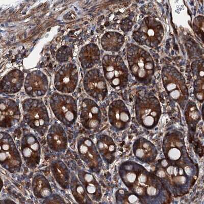 Immunohistochemistry-Paraffin: MOS Antibody [NBP1-86241]
