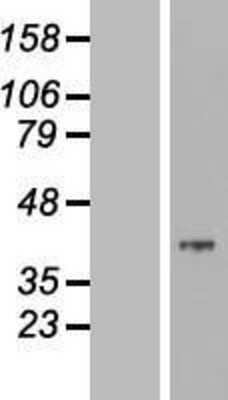 Western Blot: MOSC2 Overexpression Lysate [NBL1-13190]