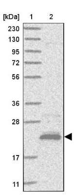 Western Blot: MOSPD1 Antibody [NBP1-84220]