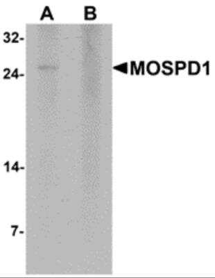 Western Blot: MOSPD1 AntibodyBSA Free [NBP2-81739]