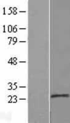 Western Blot: MOSPD1 Overexpression Lysate [NBL1-13191]