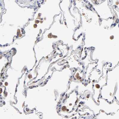 Immunohistochemistry-Paraffin: MOSPD2 Antibody [NBP1-93499]