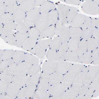 Immunohistochemistry-Paraffin: MOSPD2 Antibody [NBP1-93499]