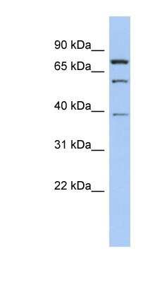 Western Blot: MOSPD2 Antibody [NBP1-91438]