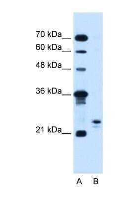 Western Blot: MOSPD3 Antibody [NBP1-60035]