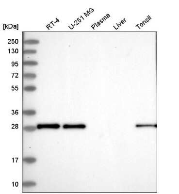 Western Blot: MOSPD3 Antibody [NBP2-57509]