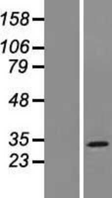 Western Blot: MOSPD3 Overexpression Lysate [NBL1-13193]