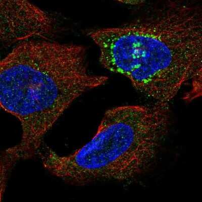 Immunocytochemistry/ Immunofluorescence: MOT13 Antibody [NBP2-57199]