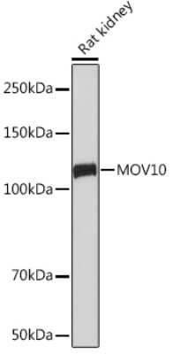 Western Blot: MOV10 Antibody (1M7M9) [NBP3-16654]