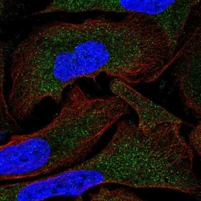 Immunocytochemistry/ Immunofluorescence: MOV10 Antibody [NBP2-55081]