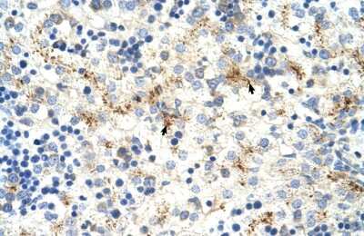 Immunohistochemistry-Paraffin: MOV10 Antibody [NBP1-57108]