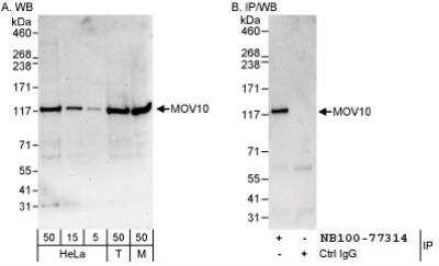 Western Blot: MOV10 Antibody [NB100-77314]