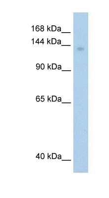 Western Blot: MOV10 Antibody [NBP1-57108]