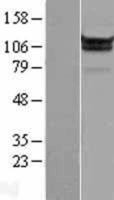 Western Blot: MOV10 Overexpression Lysate [NBP2-09505]