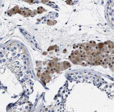 Immunohistochemistry-Paraffin: MOV10L1 Antibody [NBP1-85177]