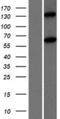 Western Blot: MOV10L1 Overexpression Lysate [NBP2-06744]