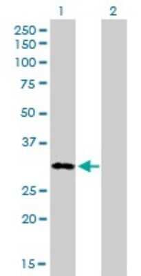 Western Blot: MOX1 Antibody (1A10) [H00004222-M01]