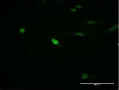 Immunocytochemistry/ Immunofluorescence: MOX1 Antibody (1F3) [H00004222-M23]