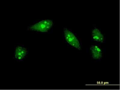 Immunocytochemistry/ Immunofluorescence: MOX1 Antibody (2E12) [H00004222-M03]