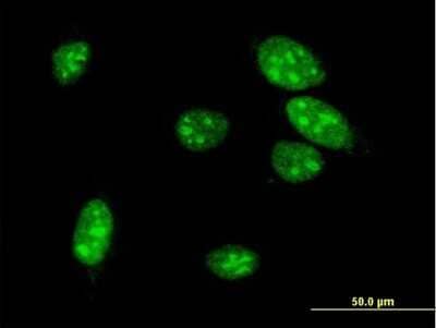 Immunocytochemistry/ Immunofluorescence: MOX1 Antibody (4B11) [H00004222-M07]