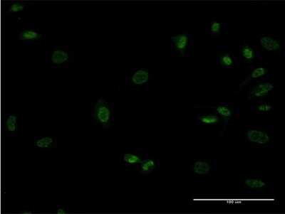 Immunocytochemistry/ Immunofluorescence: MOX1 Antibody (4E10) [H00004222-M27]