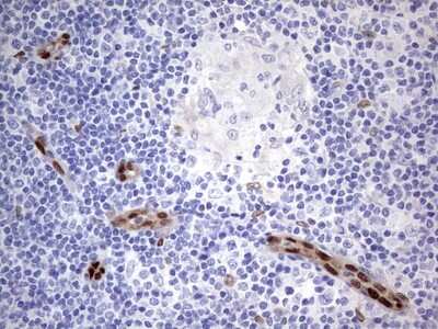 Immunohistochemistry: MOX1 Antibody (OTI5B11) [NBP2-45819]