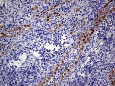 Immunohistochemistry: MOX1 Antibody (OTI5B11) [NBP2-45819]