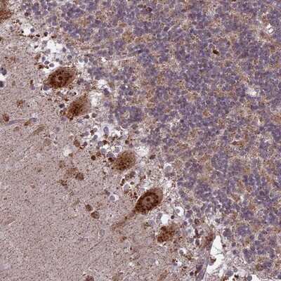 Immunohistochemistry-Paraffin: MOX1 Antibody [NBP1-92134]