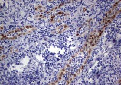 Immunohistochemistry-Paraffin: MOX1 Antibody (OTI5B11) - Azide and BSA Free [NBP2-72770]
