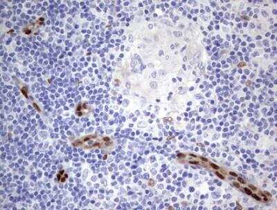 Immunohistochemistry-Paraffin: MOX1 Antibody (OTI5B11) - Azide and BSA Free [NBP2-72770]