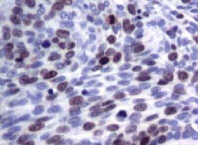 Immunohistochemistry-Paraffin: MOX1 Antibody (OTI5B11) [NBP2-45819]