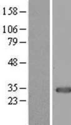 Western Blot: MOX1 Overexpression Lysate [NBL1-13009]