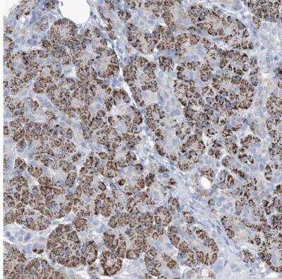 Immunohistochemistry-Paraffin: MOXD1 Antibody [NBP1-84233]