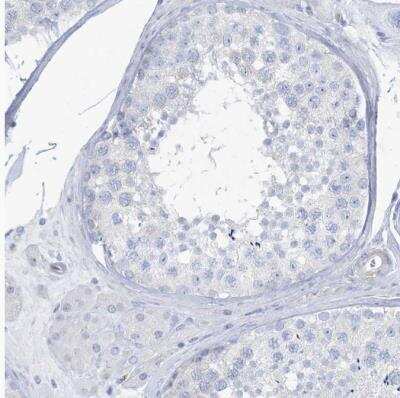 Immunohistochemistry-Paraffin: MOXD1 Antibody [NBP1-84233]