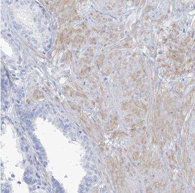 Immunohistochemistry-Paraffin: MOXD1 Antibody [NBP1-84233]