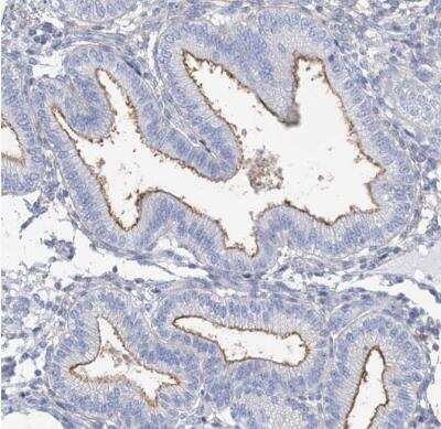 Immunohistochemistry-Paraffin: MOXD1 Antibody [NBP1-84233]