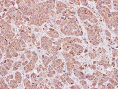 Immunohistochemistry-Paraffin: MOXD1 Antibody [NBP2-19385]