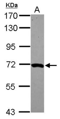 Western Blot: MOXD1 Antibody [NBP2-19385]