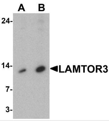 Western Blot: MP1/MAP2K1IP1 AntibodyBSA Free [NBP2-81886]