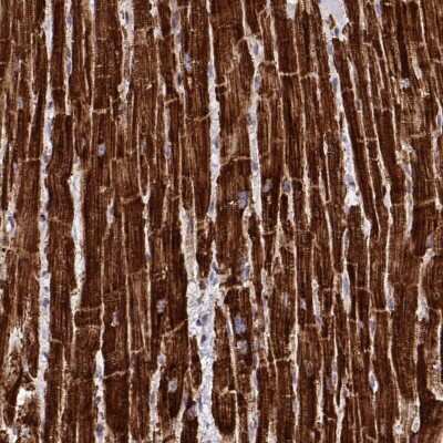 Immunohistochemistry-Paraffin: MP68 Antibody [NBP2-34119]