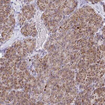 Immunohistochemistry-Paraffin: MP68 Antibody [NBP2-34119]