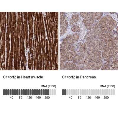 Immunohistochemistry-Paraffin: MP68 Antibody [NBP2-34119]