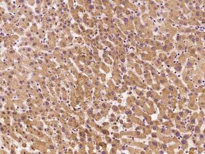 Immunohistochemistry: MPDU1 Antibody [NBP2-97487]