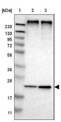 Western Blot: MPDU1 Antibody [NBP1-84570]