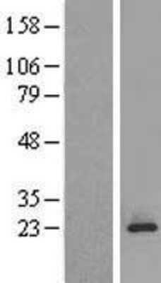 Western Blot: MPDU1 Overexpression Lysate [NBL1-13196]