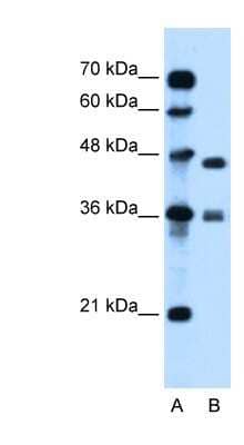 Western Blot: MPG Antibody [NBP1-59730]