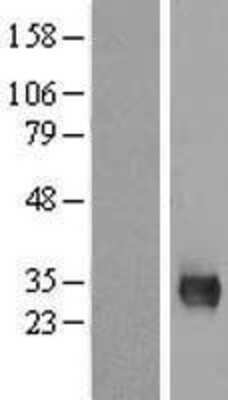 Western Blot: MPG Overexpression Lysate [NBL1-13197]