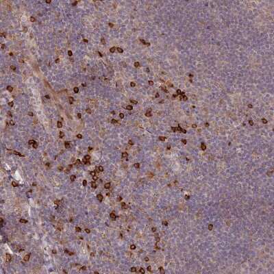 Immunohistochemistry-Paraffin: MPG1 Antibody [NBP2-14246]