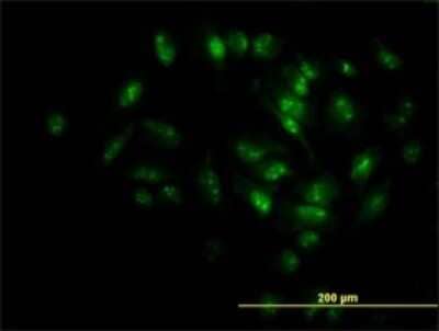 Immunocytochemistry/ Immunofluorescence: MPHOSPH10 Antibody (1B10) [H00010199-M02]